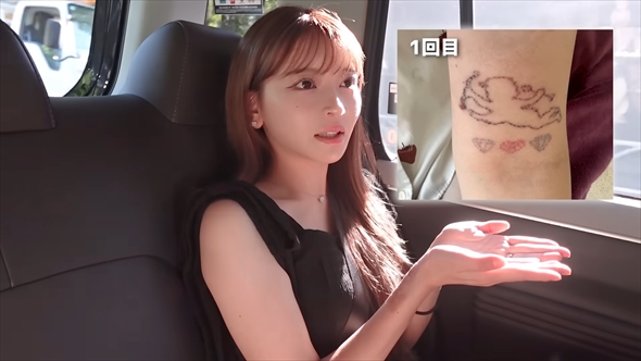 タトゥー除去の経過を報告する黒崎みさ