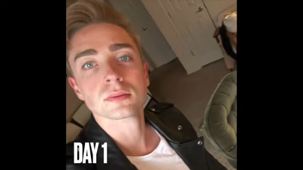 1日目の髭の様子