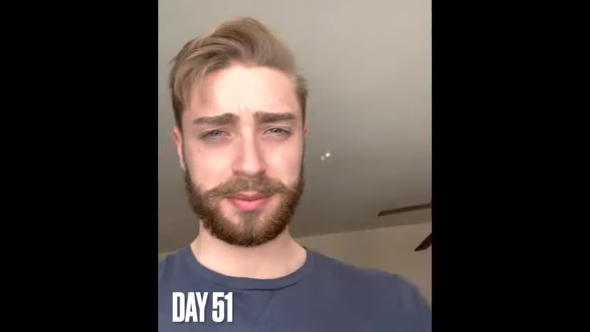 51日目の髭の様子