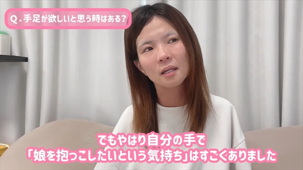 人生で最も“手がほしいと思った瞬間”を告白する先天性四肢欠損症のタレント・佐野有美