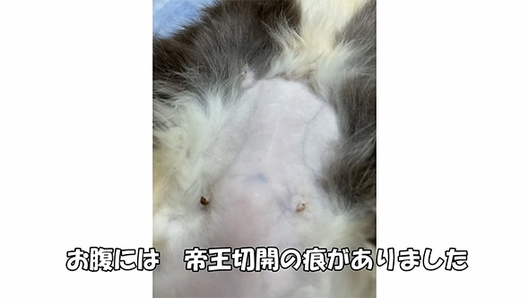 おなかには帝王切開の