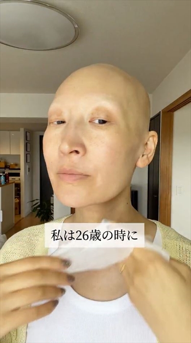 全身脱毛症の46歳ママがすっぴん→フルメイクでオシャレしたら