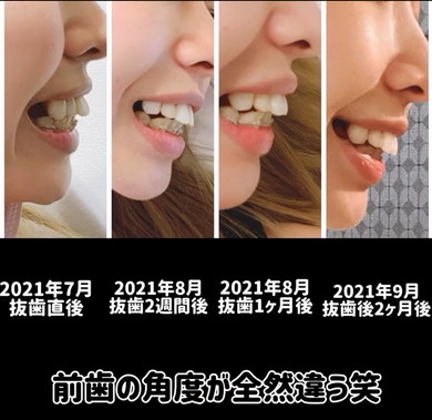 凄い前歯 sddefault.jpg