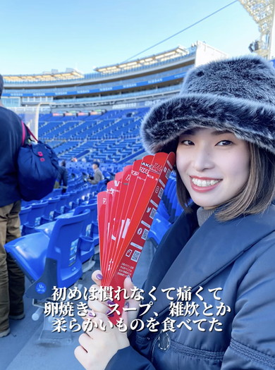 ワイヤー矯正ビフォアフ