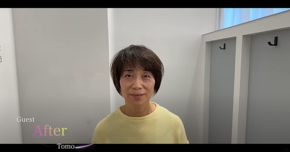 70代女性のビフォーアフター