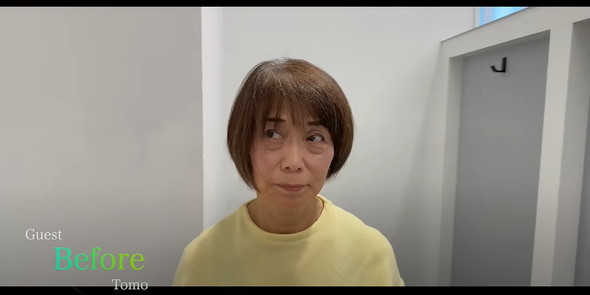 70代女性のビフォーアフター