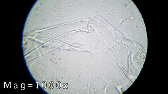 1年間放置したリンゴが入っていた水を顕微鏡で調べる