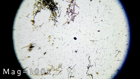 1年間放置したリンゴが入っていた水を顕微鏡で調べる