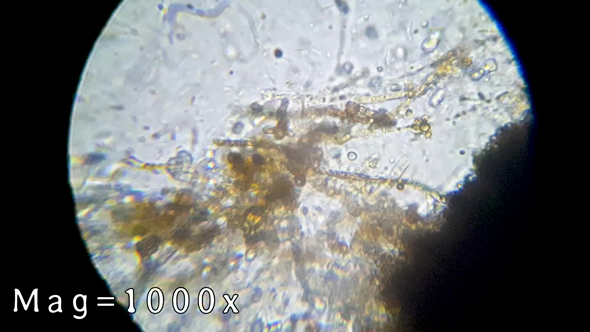 1年間放置したリンゴが入っていた水を顕微鏡で調べる