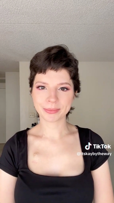 乳ガン 抗がん剤治療