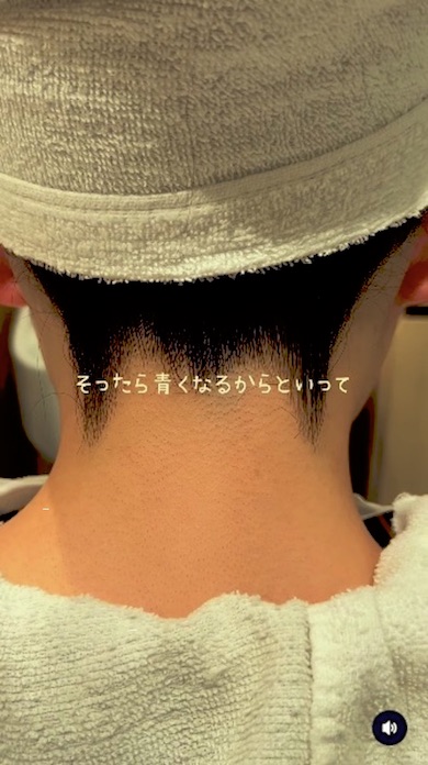 みつえりを剃った後