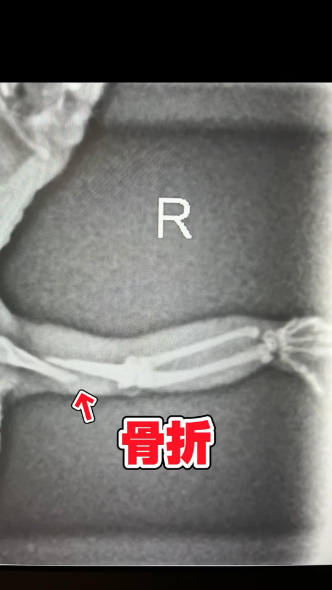 レントゲン写真