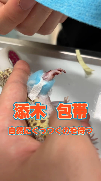 包帯で治療