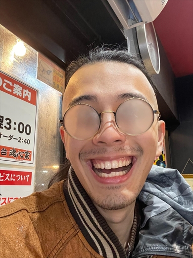 笑顔がまぶしい美少年が大人になったビフォーアフター