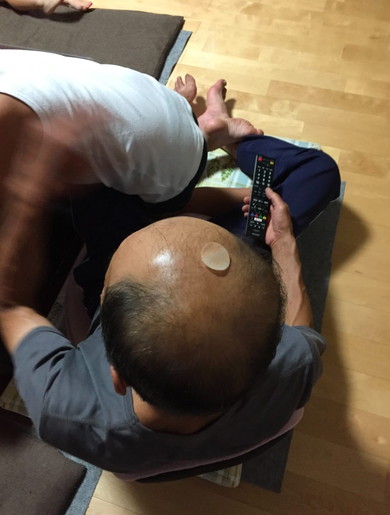 ムヒパッチが貼ってある頭皮