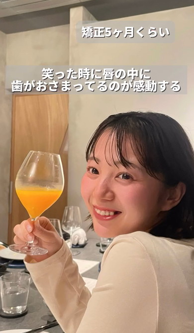 ワイヤー矯正ビフォーアフター