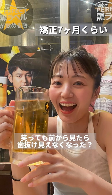 ワイヤー矯正ビフォーアフター