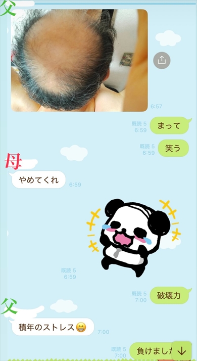 家族に10円ハゲを伝えたときの反応