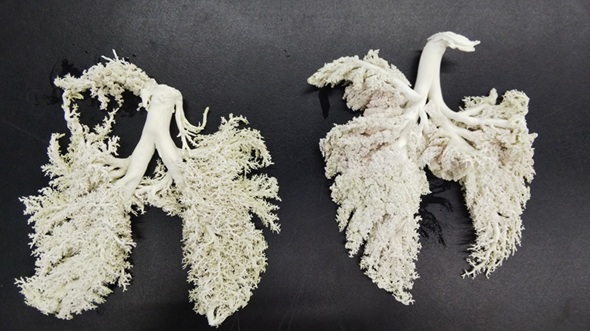 本物のブタの肺にシリコーン樹脂を流して作った標本