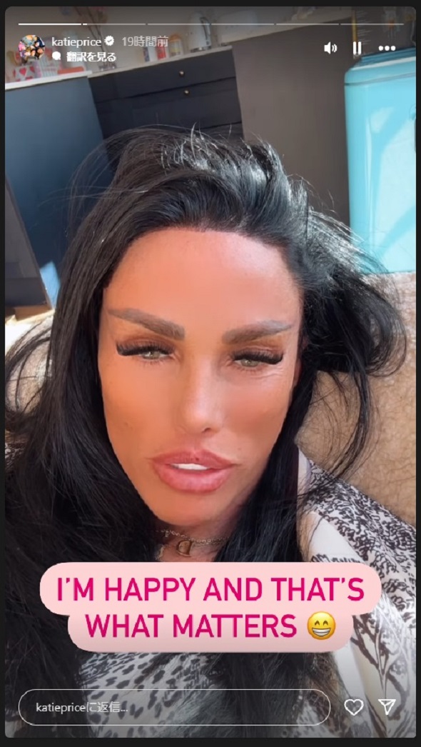 歯が大きすぎると話題のケイティ・プライス