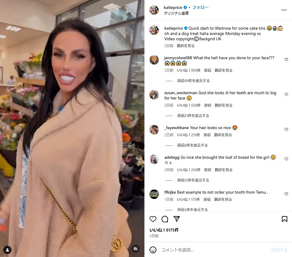 歯が大きすぎると話題のケイティ・プライス