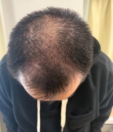 ミルクボーイ 内海崇