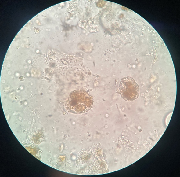 トリュフ塩のトリュフは本物？