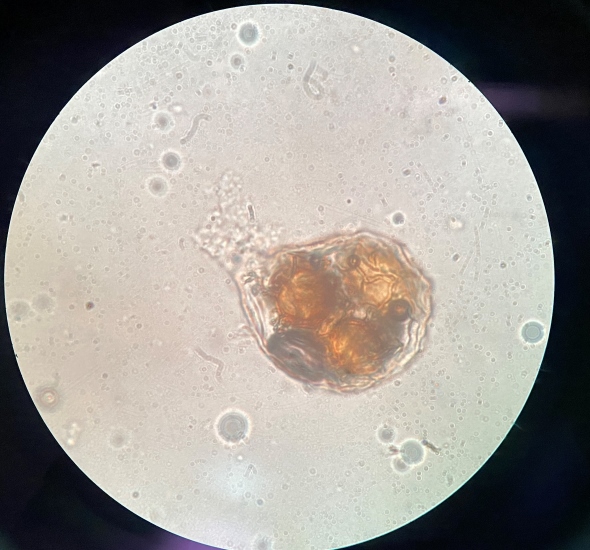 トリュフ塩のトリュフは本物？