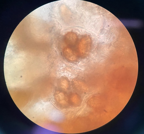 トリュフ塩のトリュフは本物？