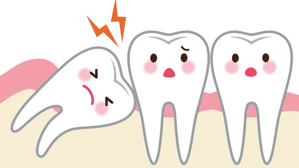 デカすぎる親知らず