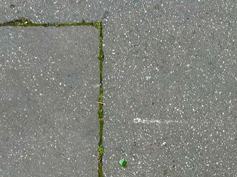 “歩道の外科医”のストリートアート