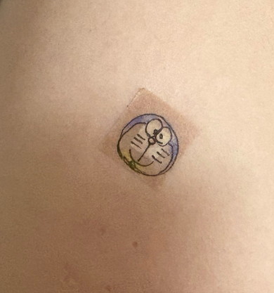 保護シールが貼られた腕