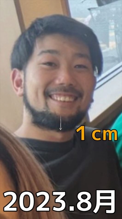 1年7カ月ヒゲを伸ばすと何センチになる？