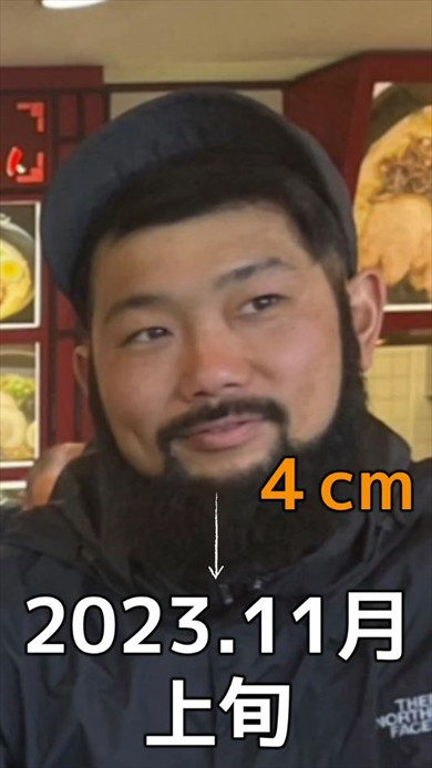 1年7カ月ヒゲを伸ばすと何センチになる？