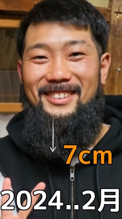 1年7カ月ヒゲを伸ばすと何センチになる？