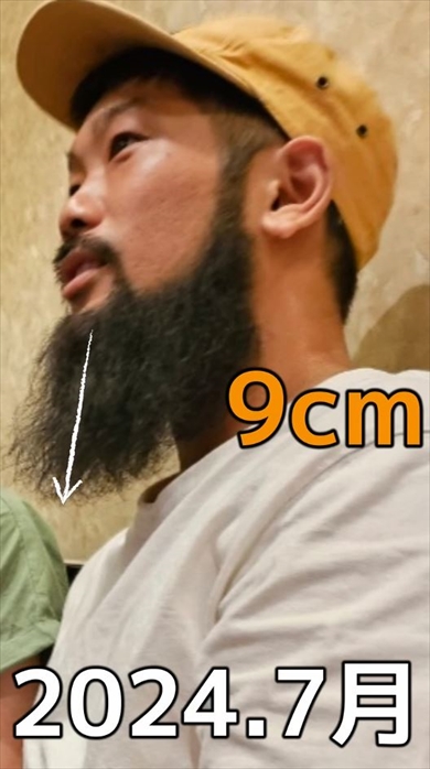 1年7カ月ヒゲを伸ばすと何センチになる？