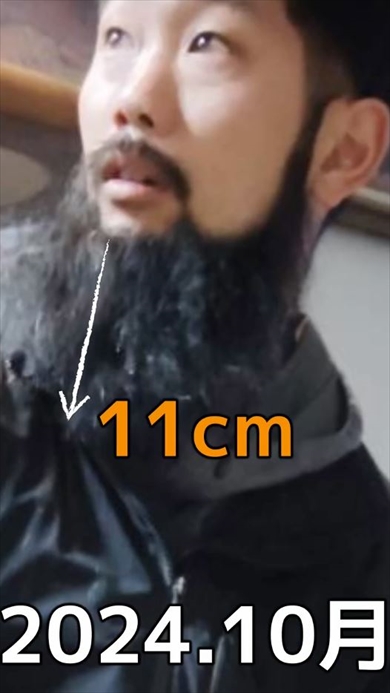 1年7カ月ヒゲを伸ばすと何センチになる？