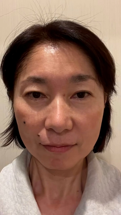 インスタビフォー