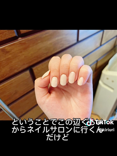 深爪を1年かけて矯正した記録