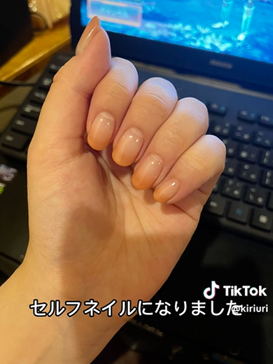 深爪を1年かけて矯正した記録