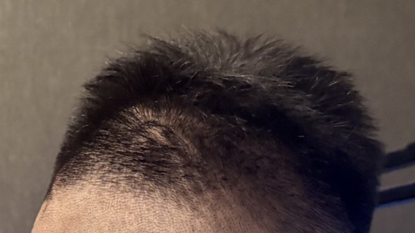 ヘアカット後の後頭部を見たら