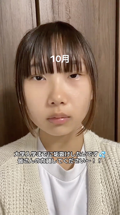 大学入学までに垢抜けを目指した女性